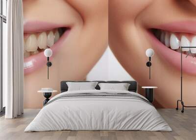 Visual display of teeth transformation through professional whitening. Before and after collage Wall mural