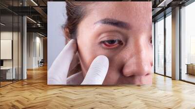 The hands of an ophthalmologist and a young Asian patient. Visiting the eye health Wall mural