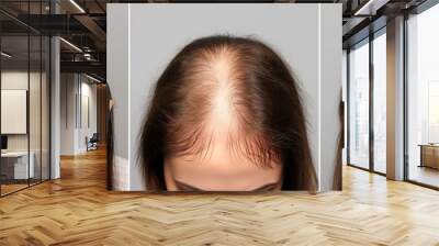 Woman with hair loss problem before and after treatment on grey background, collage. Visiting trichologist Wall mural