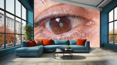 Macro photos of the human eye - cataract clouding of the lens, deterioration of vision. Treatment, surgery and ophthalmology Wall mural