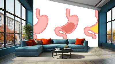 Healthy and unhealthy, empty and full human stomach in trendy flat style. Nutrition, stomach pain, bloating. Digestive system anatomy. Vector illustration isolated on white background Wall mural