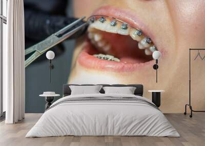 A woman at a dentist's appointment to replace arches with braces. Wall mural