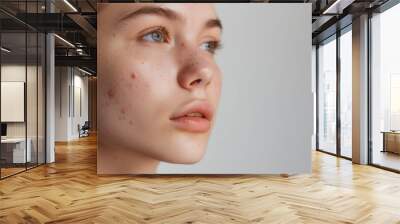 A young woman with acne on her face looks up with a sad expression. The close-up photo captures the detail of her skin. Generative AI Wall mural