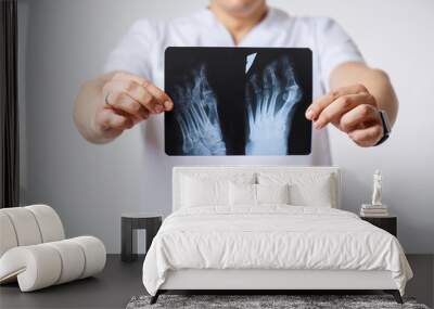 Young male doctor in a white surgical suit holds and examines an x-ray picture of the patient's leg bones .Isolated on a white background Wall mural