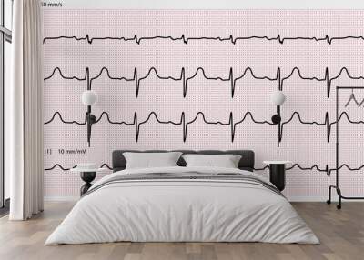 Electrocardiogram paper texture, millimeter paper texture. Vector illustration. Wall mural