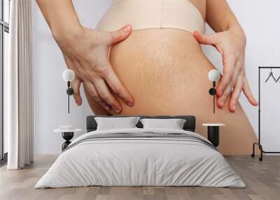 Close-up of a female thigh with white stretch marks from a sharp weight loss or weight gain isolated on a white background. Changes in the body. Cosmetology, beauty Wall mural