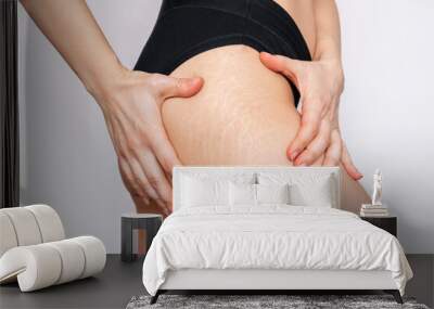 Cropped shot of a young woman with white stretch marks from a weight loss or weight gain on her thigh isolated on a white background. Changes in the body. Cosmetology, beauty Wall mural