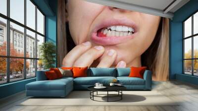 Gum inflammation. Close-up of a young woman showing bleeding gums. Dentistry, dental care Wall mural