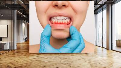 Gum inflammation. Cropped shot of a young woman's face with doctor's hand in a blue glove showing red bleeding gums isolated on a white background. Examination at the dentist. Dentistry, dental care Wall mural