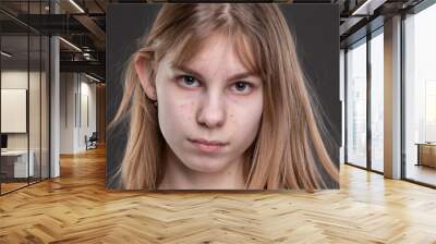 The face of a teenage girl with pimples close-up on a gray background. Wall mural